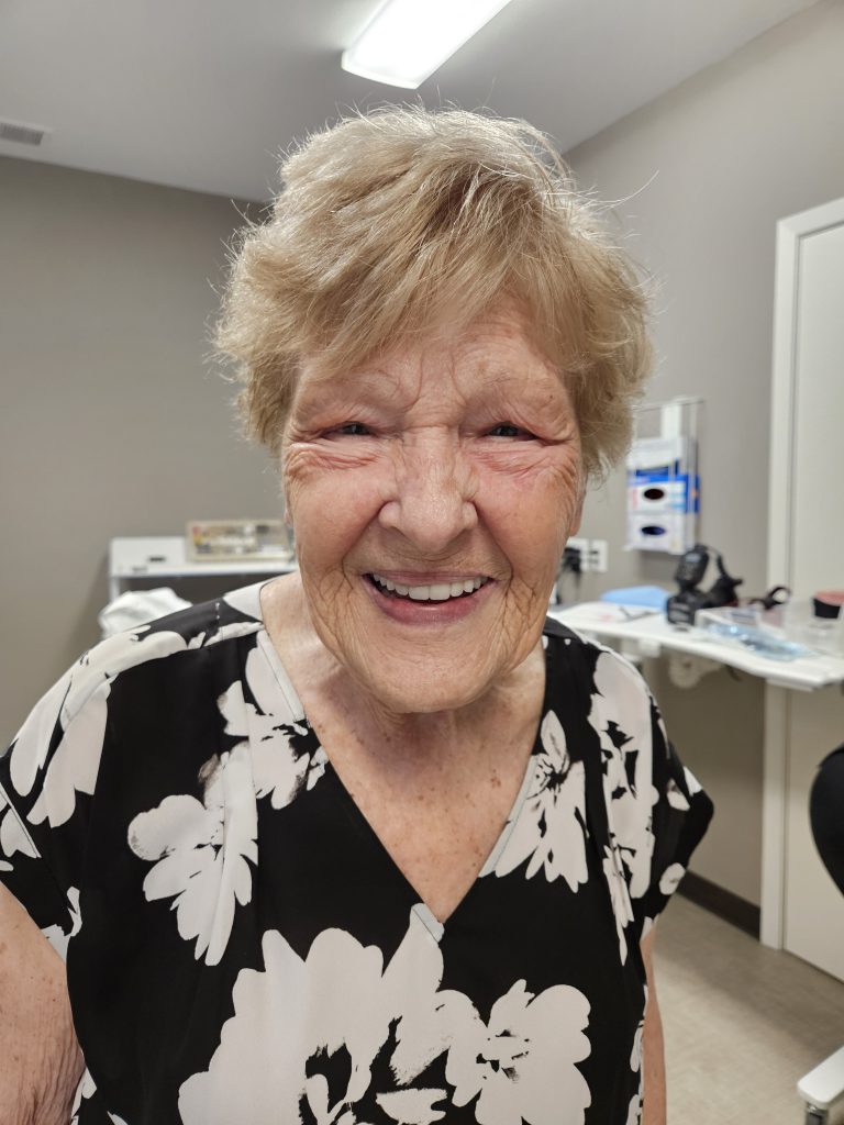 Full Mouth Dental Implants, patient results