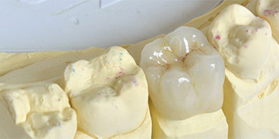 Local Family Dentist in Salem Oregon