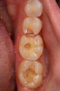 Local Family Dentistry in Salem OR