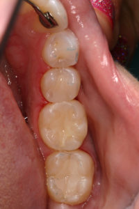 Local Family Dentistry in Salem OR