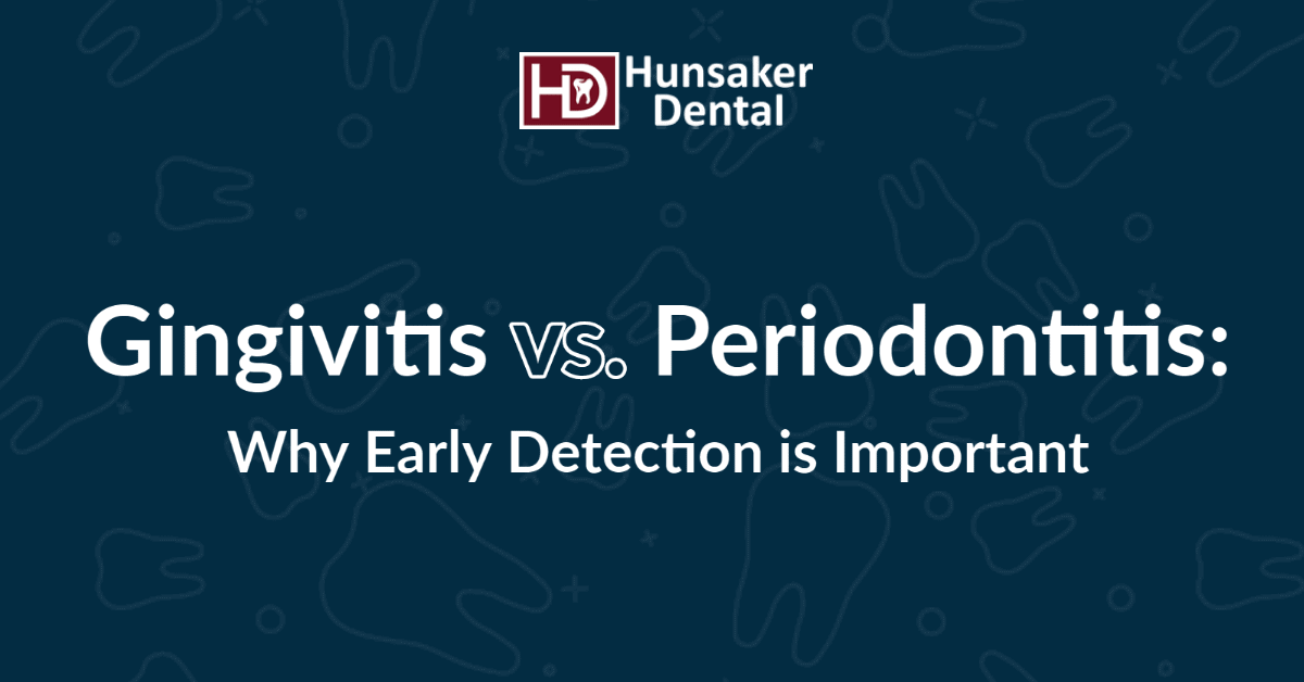 Gingitivitis vs Periodontitis salem oregon dentist hunsaker dental_FBLocal Family Dentistry in Salem OR