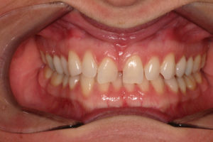 Monmouth Dentist and Local Family Dentistry in Salem OR