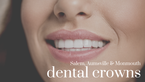 Why Do I Need A Dental Crown - Local Family Dentistry for dental crowns in Salem Oregon