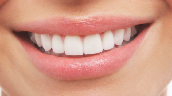 Invisalign in Salem Oregon