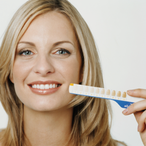 Teeth Whitening Local Family Dentist in Salem and Monmouth Oregon