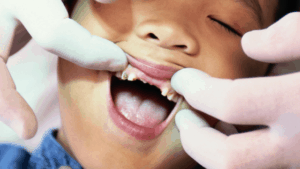 Don't Let A Injury Ruin Your Beautiful Smile