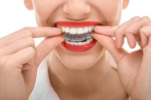 Local Family Dentistry in Salem OR