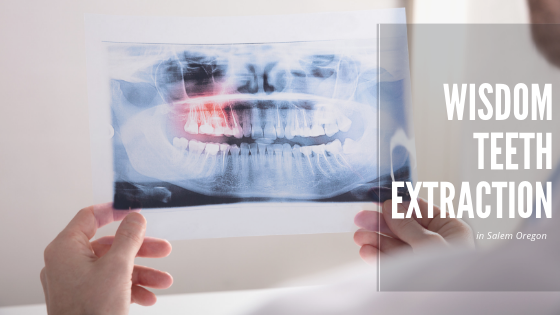 Local Family Dentistry in Salem OR