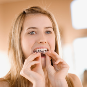 Invisalign Braces in Aumsville Salem Monmouth Oregon
