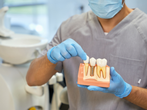 do i need a dental implant ? dentist holding dental implant anatomy