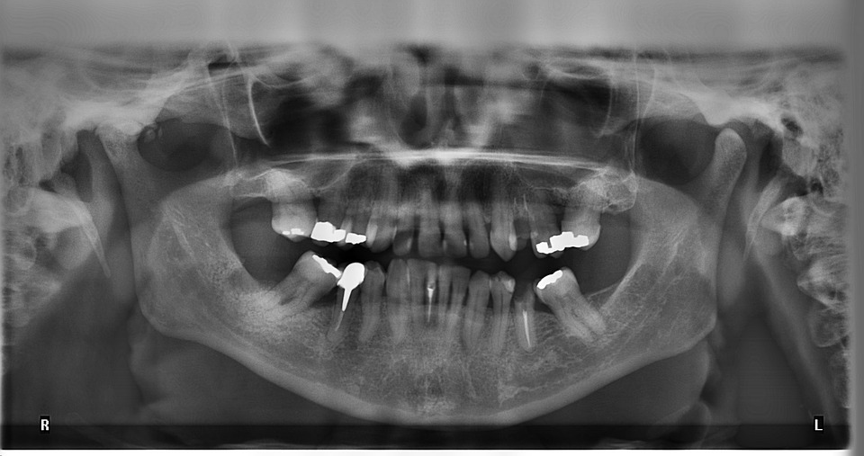Local Family Dentistry in Salem OR