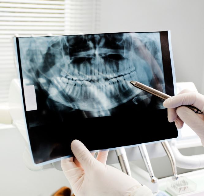 Hunsaker Dental, Digital Imaging & X-Rays, Dental Technologies