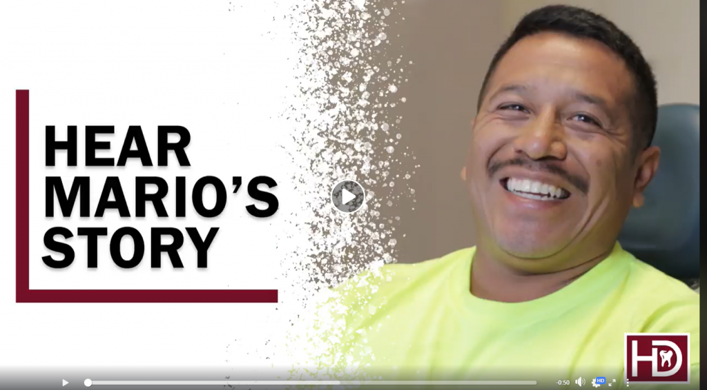 Mario shares his experience with Teeth Whitening with Salem and Monmouth Dentist at Hunsaker Dental
