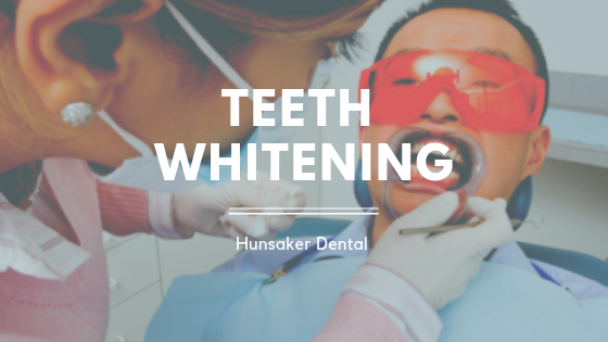 Teeth Whitening Local Family Dentist in Salem OR